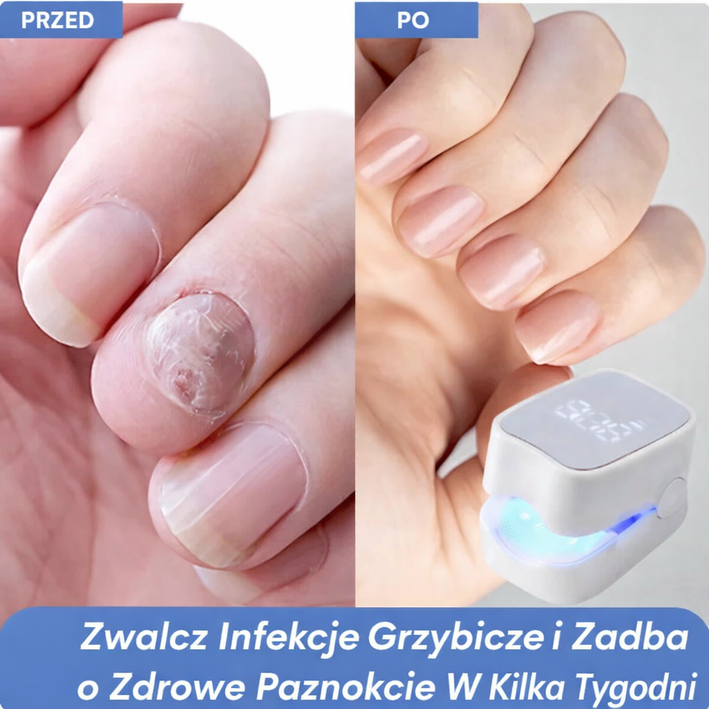 PureNail Pro™ Laserowa precyzja, widoczne efekty