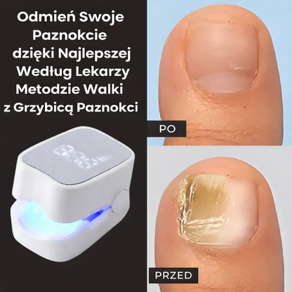 PureNail Pro™ Laserowa precyzja, widoczne efekty